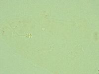 Hebesuncus conjungens image
