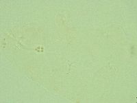 Hebesuncus conjungens image
