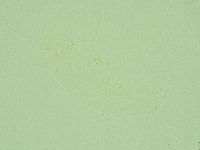 Hebesuncus conjungens image