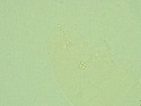 Hebesuncus conjungens image