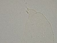 Hebesuncus conjungens image
