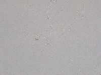 Hebesuncus conjungens image