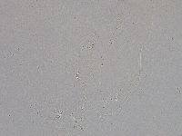 Hebesuncus conjungens image