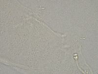 Hebesuncus conjungens image