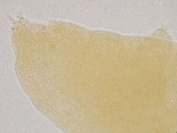 Hebesuncus conjungens image
