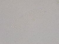 Hebesuncus conjungens image