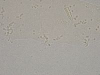 Diphascon higginsi image