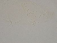 Diphascon higginsi image