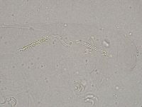 Diphascon higginsi image