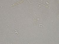 Diphascon higginsi image