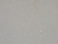 Diphascon higginsi image