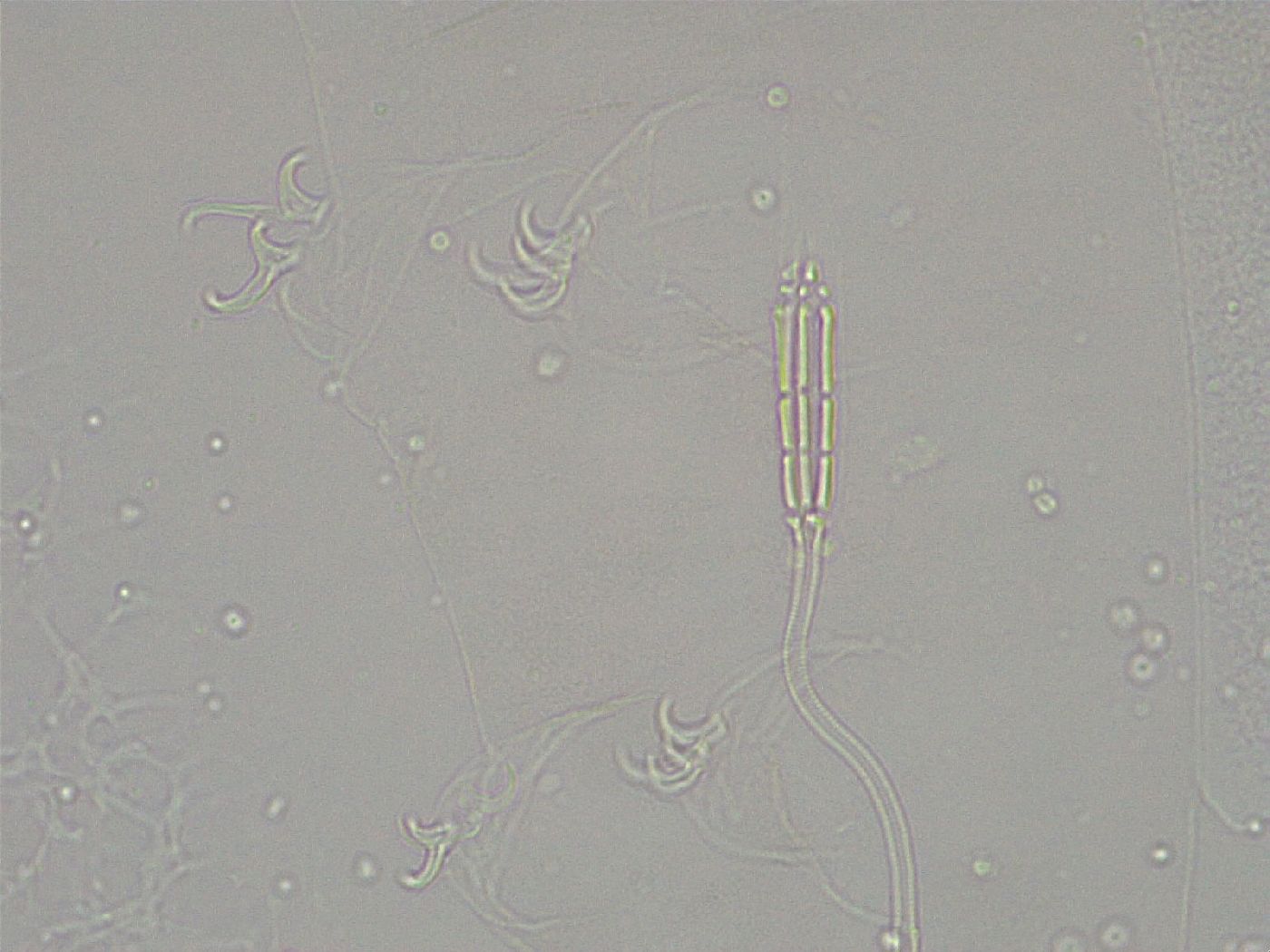 Diphascon higginsi image