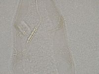 Diphascon higginsi image