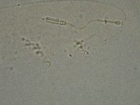 Diphascon higginsi image