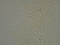 Diphascon higginsi image