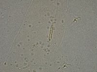 Diphascon higginsi image