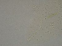 Diphascon higginsi image
