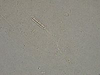 Diphascon higginsi image