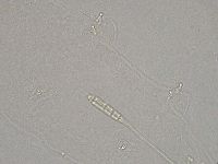 Diphascon higginsi image