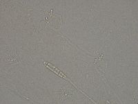 Diphascon higginsi image