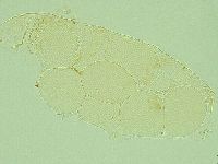 Pilatobius iltisi image