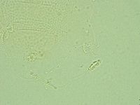 Pilatobius iltisi image