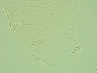 Pilatobius iltisi image