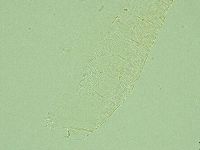 Pilatobius iltisi image