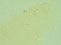Pilatobius iltisi image
