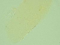 Pilatobius iltisi image