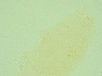 Pilatobius iltisi image