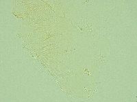 Pilatobius iltisi image