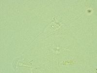 Pilatobius iltisi image