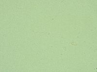 Diphascon alpinum image