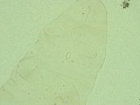 Diphascon alpinum image
