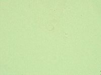 Diphascon alpinum image