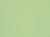 Diphascon alpinum image