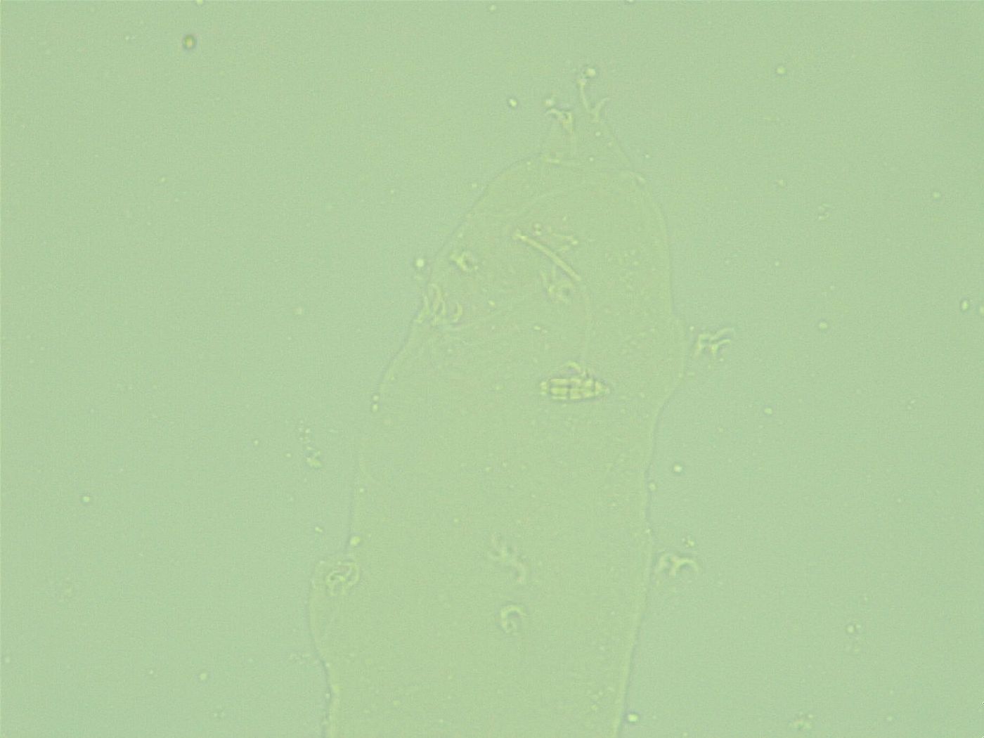 Diphascon alpinum image