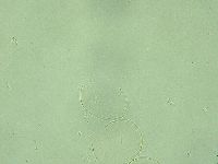 Diphascon alpinum image