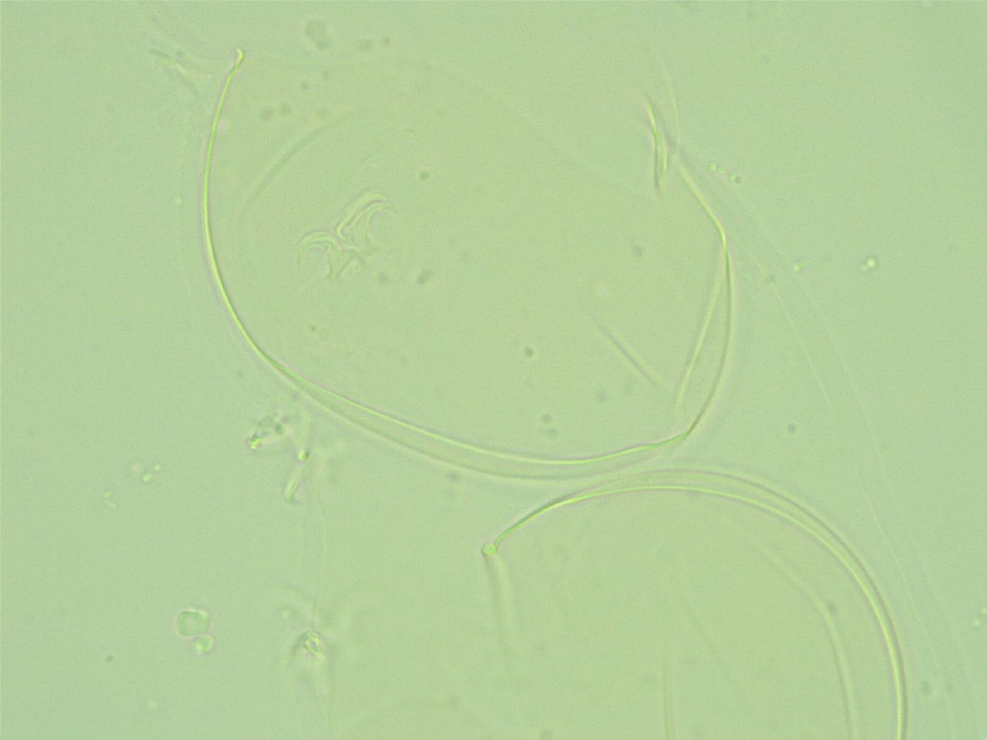 Diphascon alpinum image