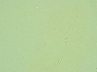 Diphascon alpinum image