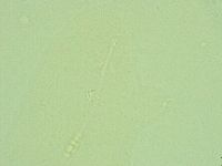 Diphascon alpinum image