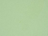 Diphascon alpinum image