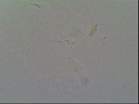 Diphascon alpinum image
