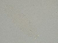 Diphascon alpinum image