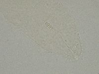 Diphascon alpinum image
