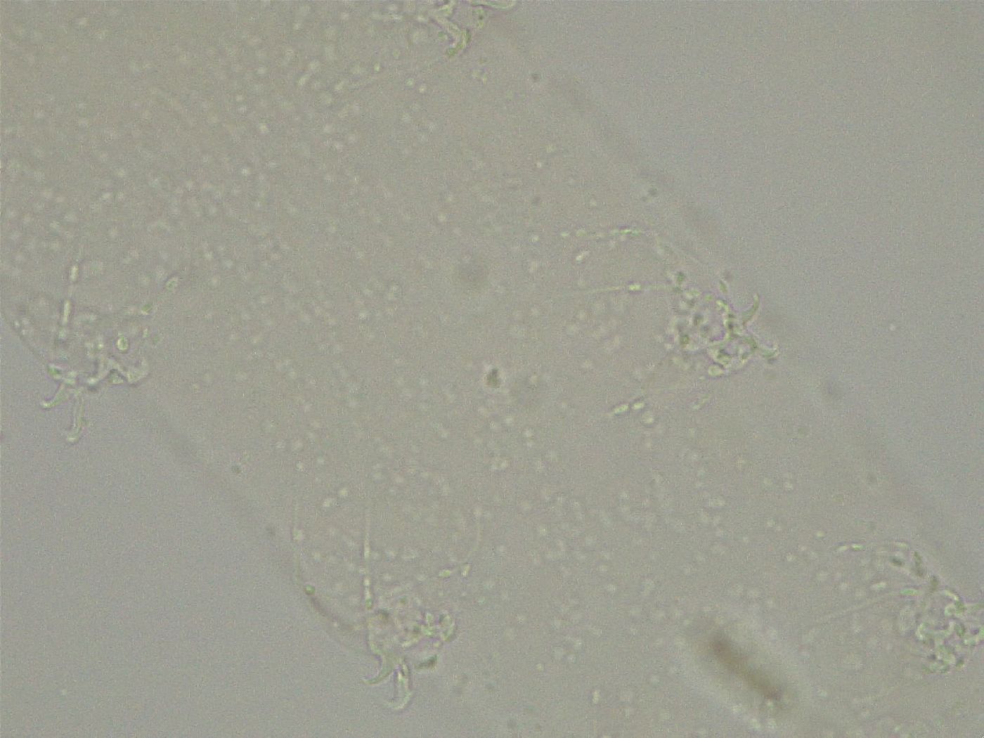 Diphascon alpinum image
