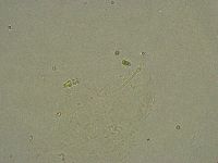 Diphascon alpinum image