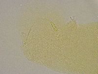 Diphascon alpinum image