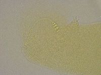 Diphascon alpinum image